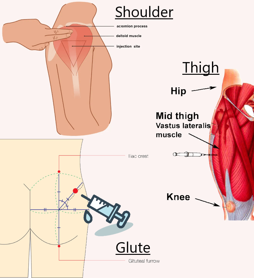 Intramuscular Injection Processes